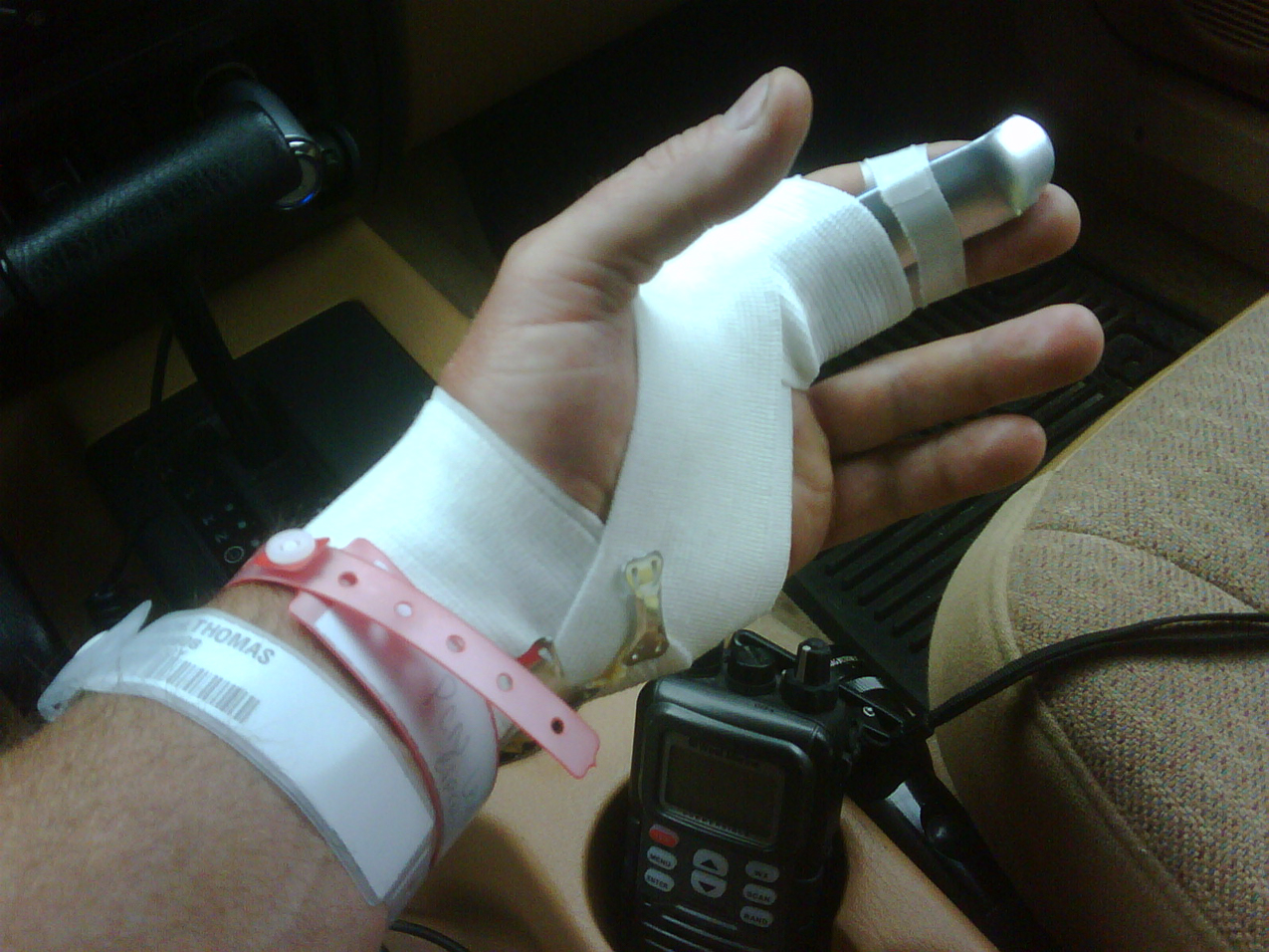 tethered my index finger tendon  ~~  must say this is one of my more painful injuries, plus i am left handed.