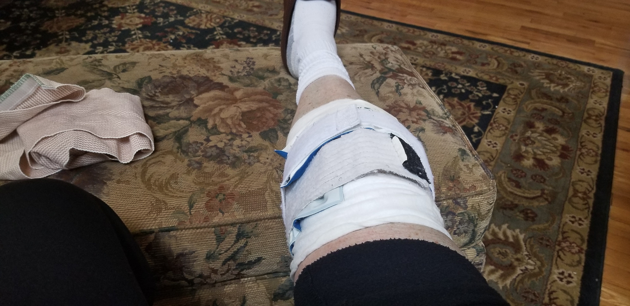   ~~  The right knee miniscus operation April 2019