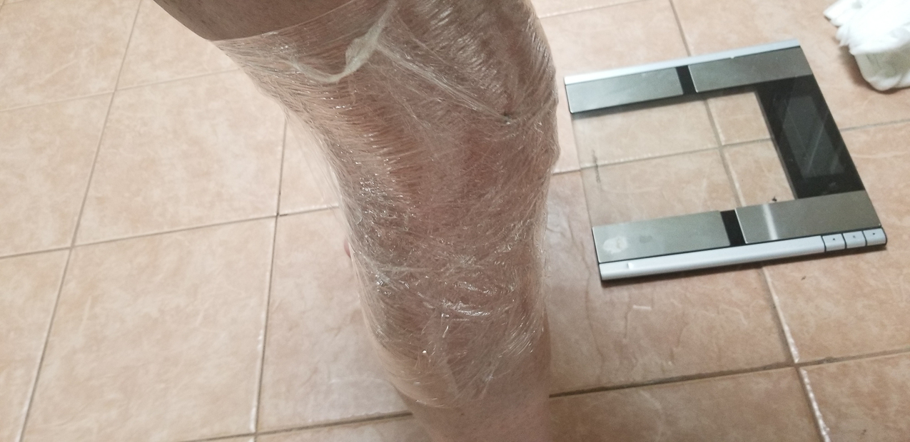   ~~  The right knee miniscus operation April 2019