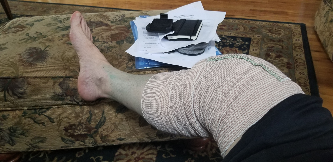   ~~  The right knee miniscus operation April 2019
