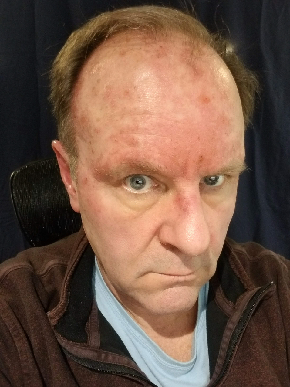 CARAC Cancer Chemo   ~~  Day 20