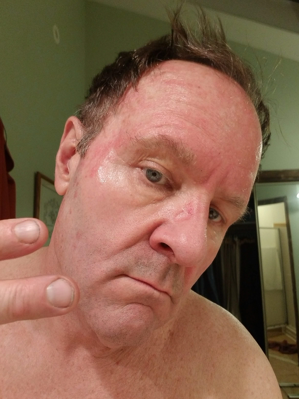 CARAC Cancer Chemo   ~~  Two days of recovery