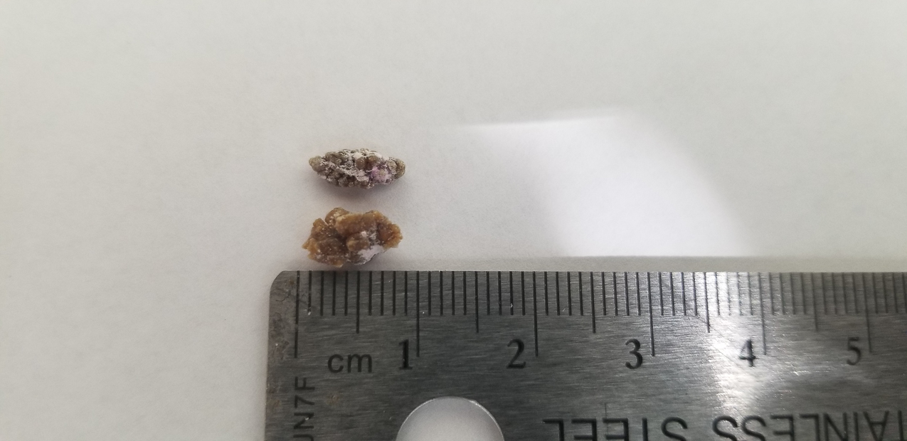 Deep Impact: ELE  and Leo my two asteroids. Kidney Stones  ~~  ELE - Extingtion Level Event and Leo is the Astronomer in the movie  Kidney Stones