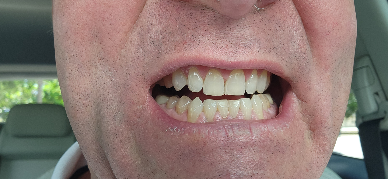 Dentistry of Venice - Dr Houston Brice   ~~  May 2024 First Visit