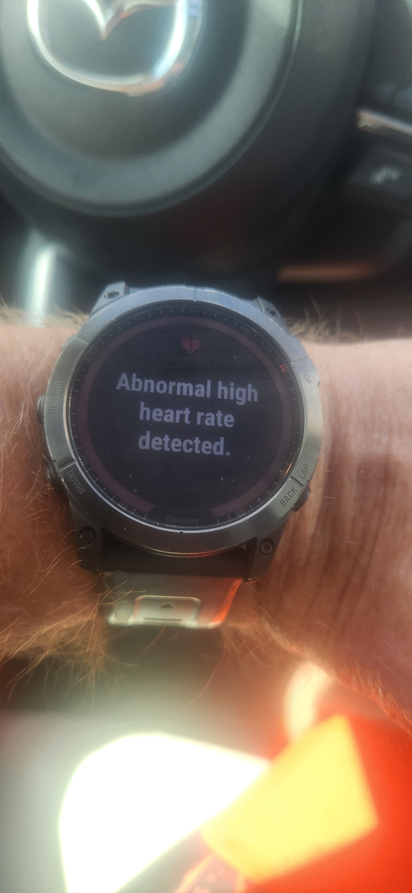 Tour de Northp Port - Metric Century (65.1 miles)   ~~  Crach Pastor Johnny Hit my bike and went down