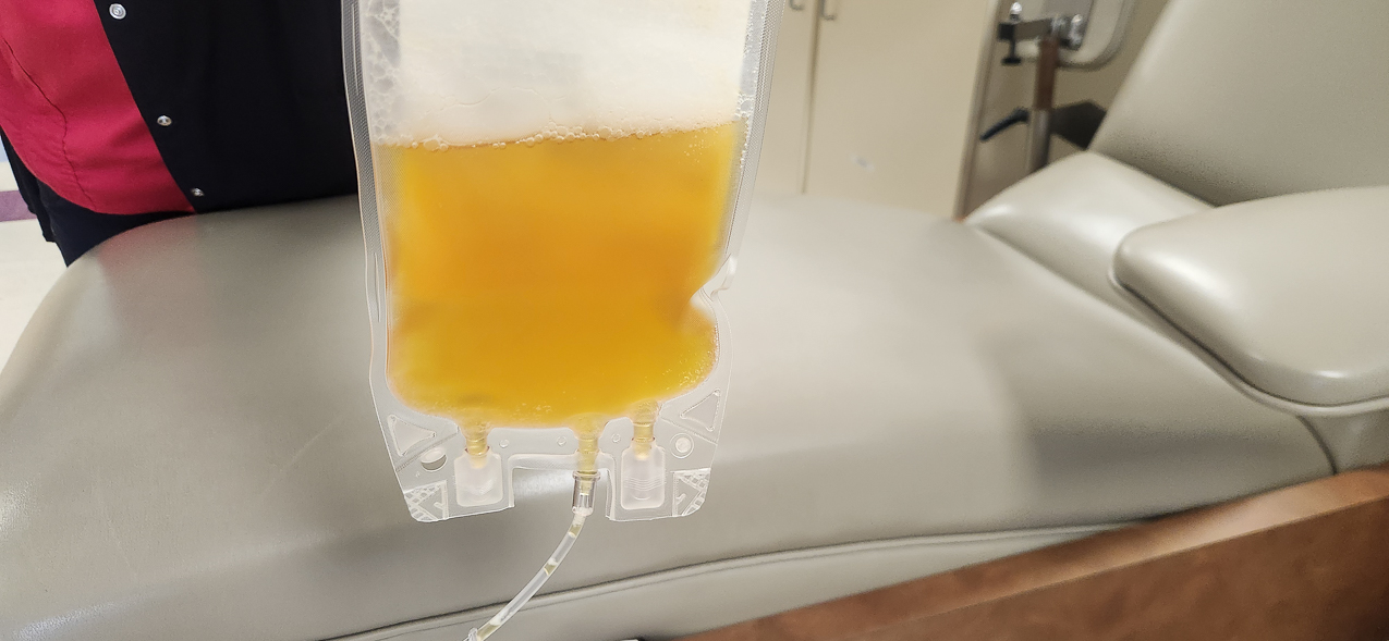 Now DATS 138 Total Cholesterol Plasma!!!  ~~  Clear as lemonaide