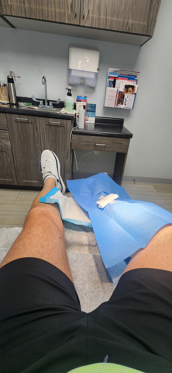 Basil Cancer Removal and the BOOT  ~~  