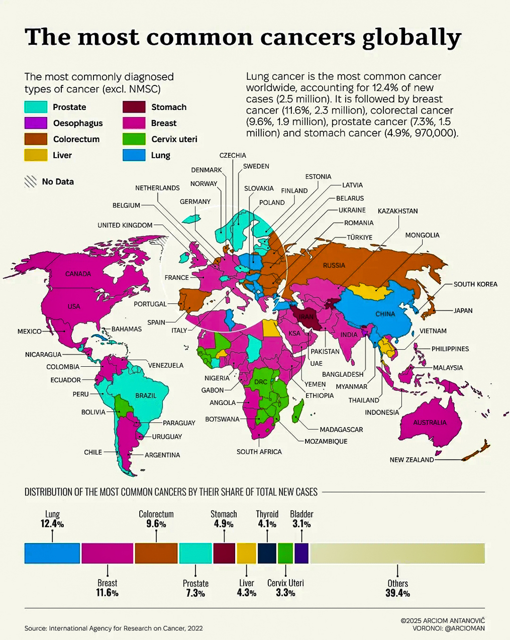 Most common Cancers Globally 2025  ~~  